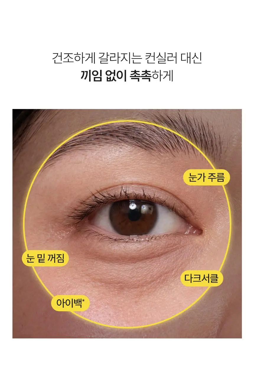 [한정기획/다크서클커버] 샤이샤이샤이 바나나 PDRN 컨실 아이크림 크림 15g (+ 미니언즈 키캡 키링) 상세페이지 14